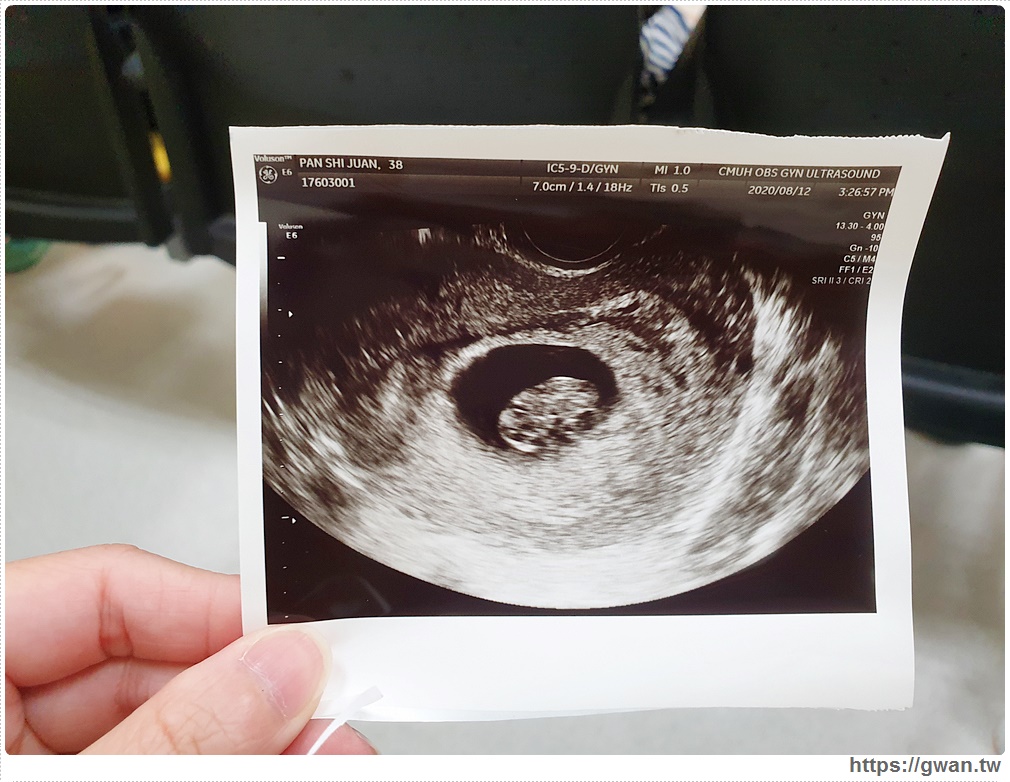 懷孕初期｜三個月可以公佈了！聽到寶寶的心跳聲